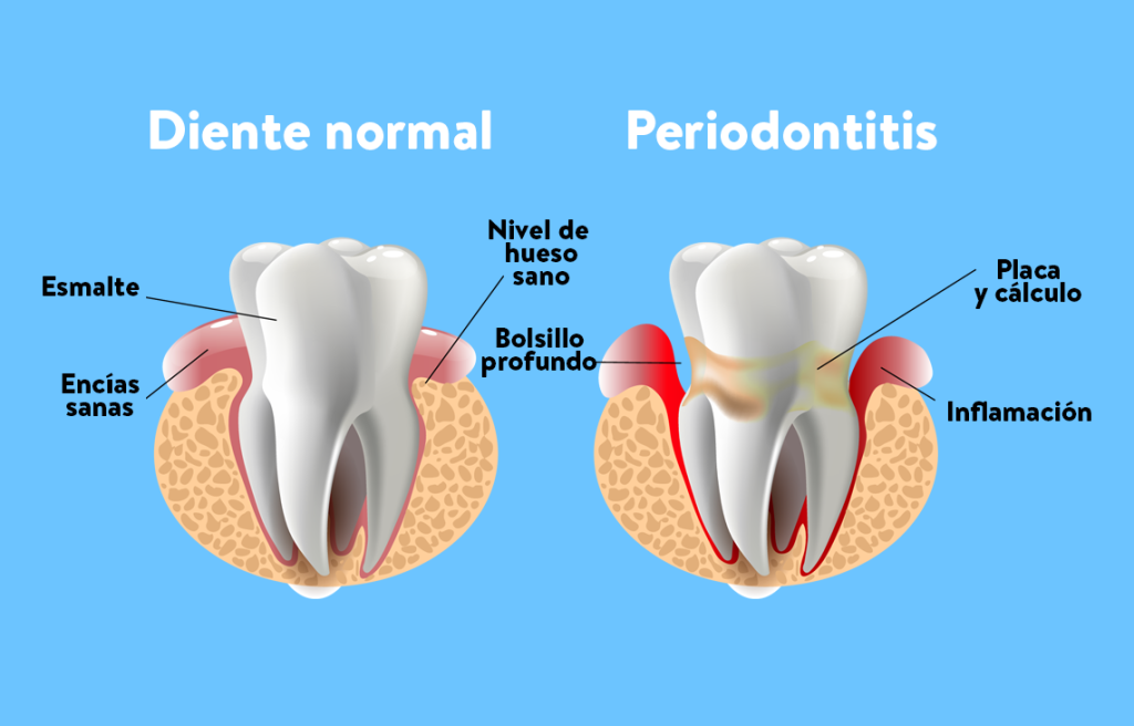 Endodoncia en jerez